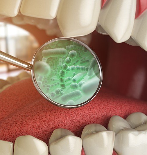 Closeup of smile being examined during periodontal diagnostics