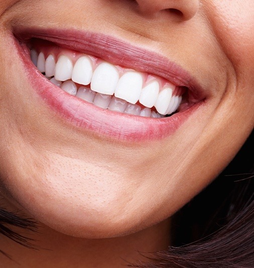 Closeup of healthy smile after cosmetic gingival surgery