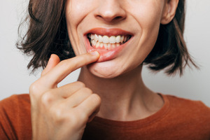 Woman pulling down lip to show signs of gum disease