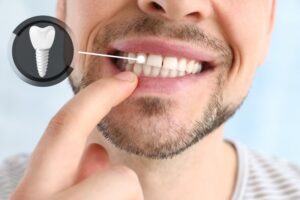 Man checking his dental implants for failure